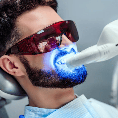 تبييض الأسنان بالليزر