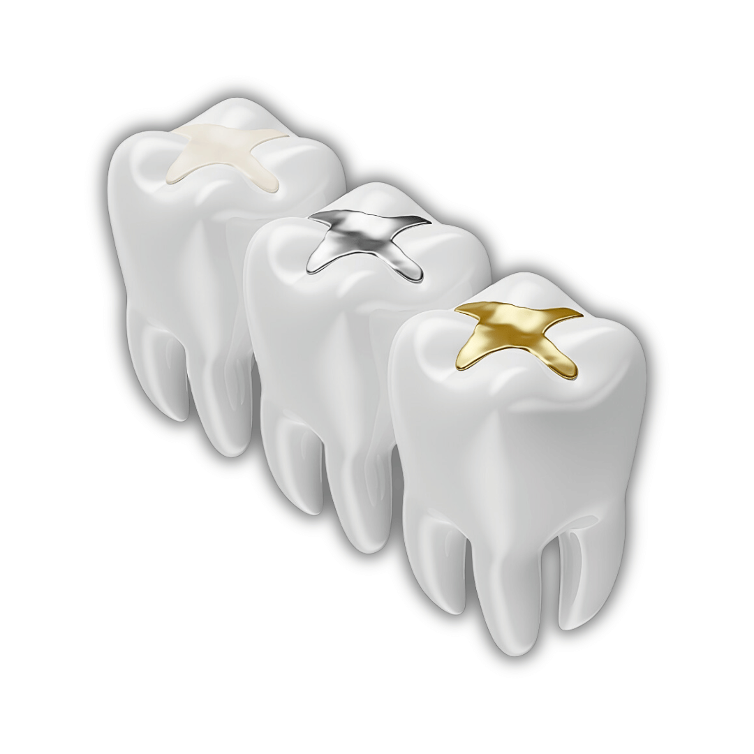 حشوات تجميلية للأسنان
