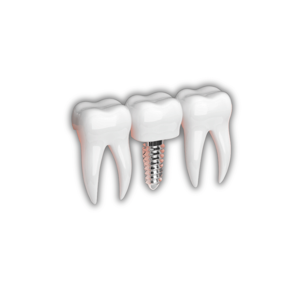 تبييض الأسنان بالليزر