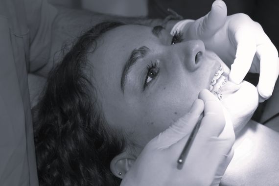 Una mujer se está haciendo examinar los dientes por un dentista.