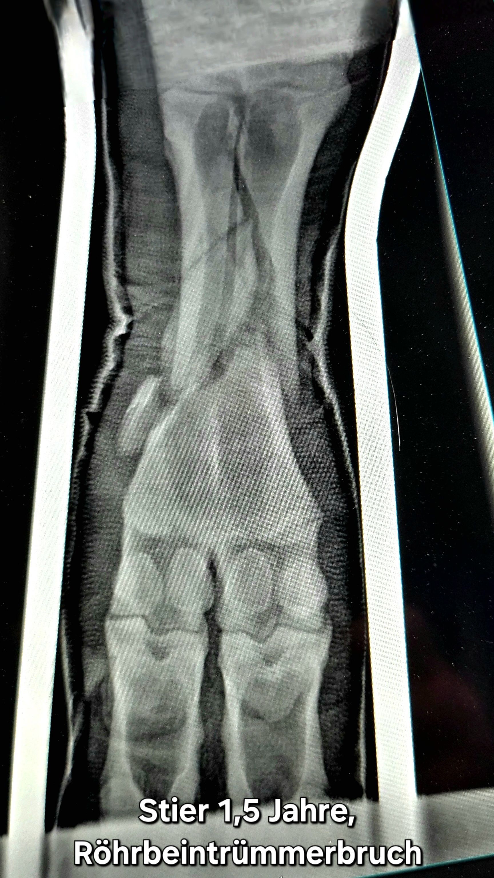 Stier, 1,5 Jahre Röhrbeintrümmerbruch