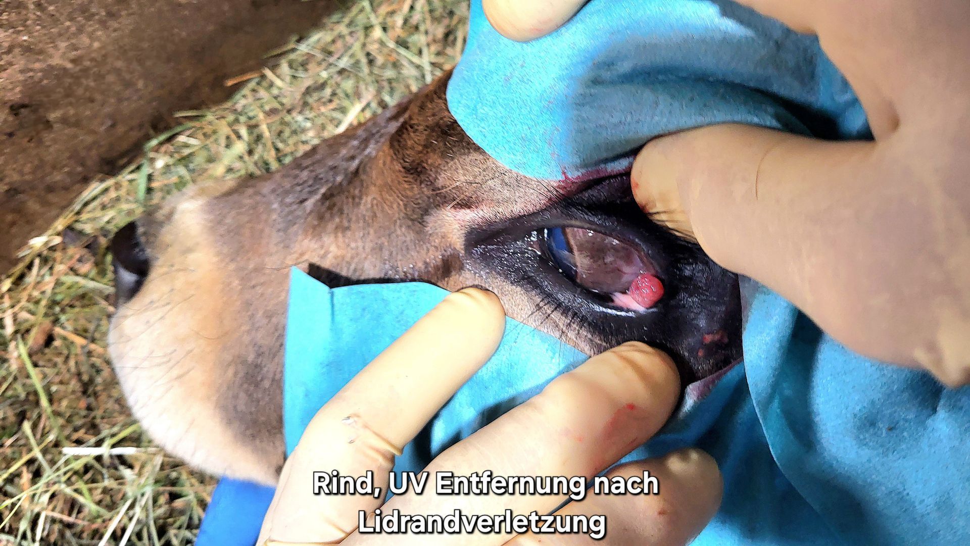 Rind, UV Entfernung nach Lidrandverletzung