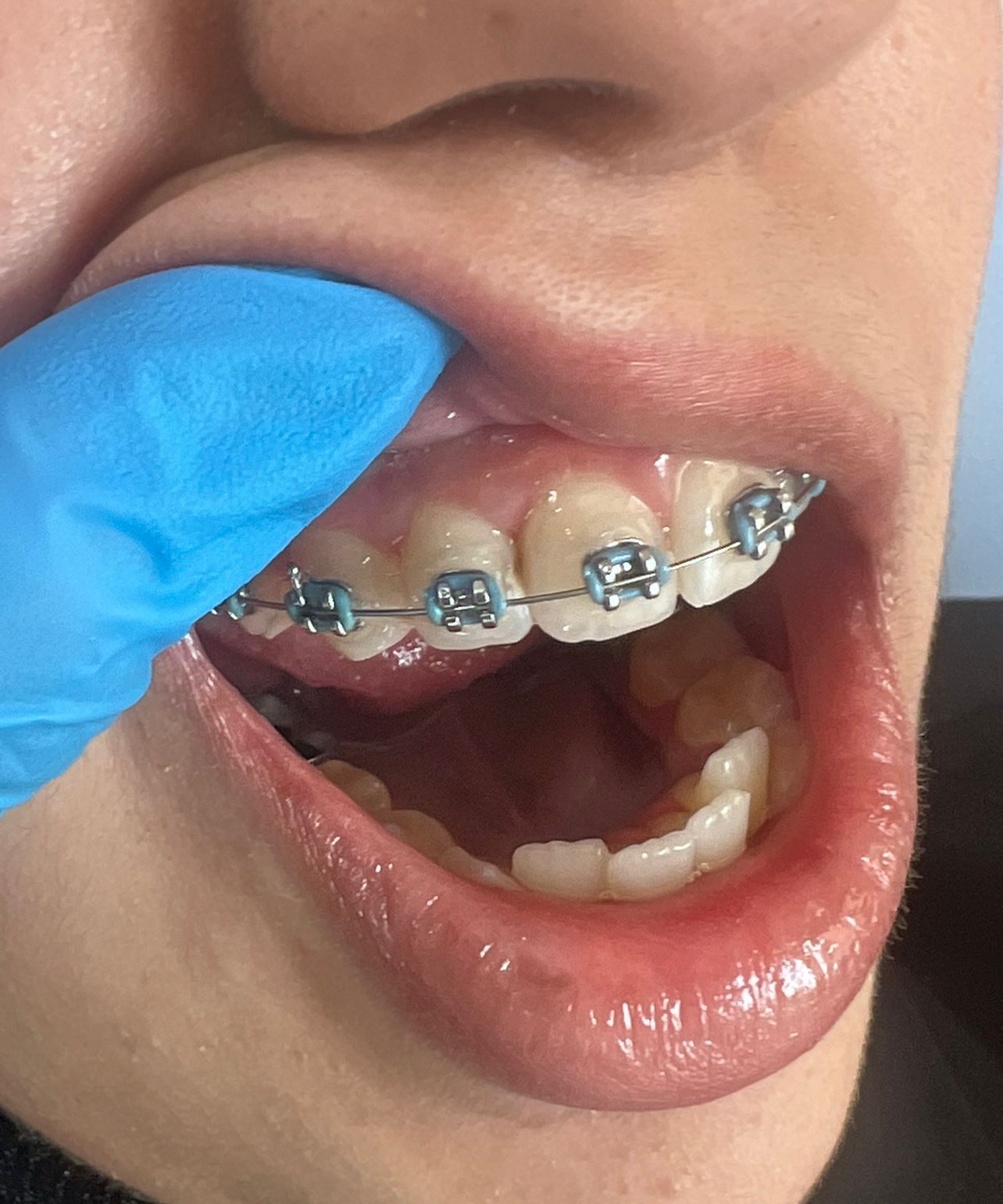 الدكتورة تسنيم ضاني لطب وجراحة الأسنان 