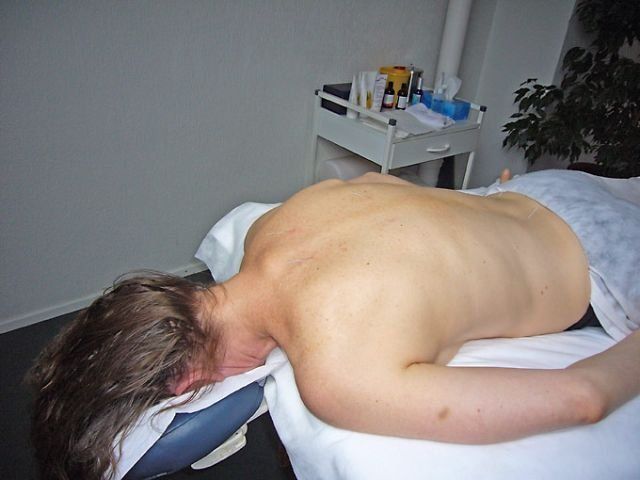 Patient bekommt eine Rücken-Akupunktur