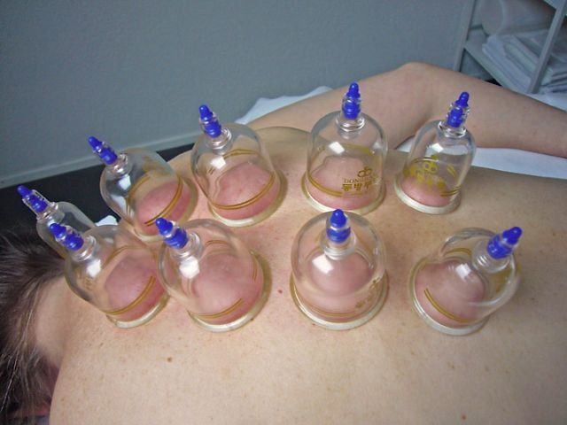 Gregory Hofer - Praxis für Akupunktur, Traditionelle Chinesische Medizin