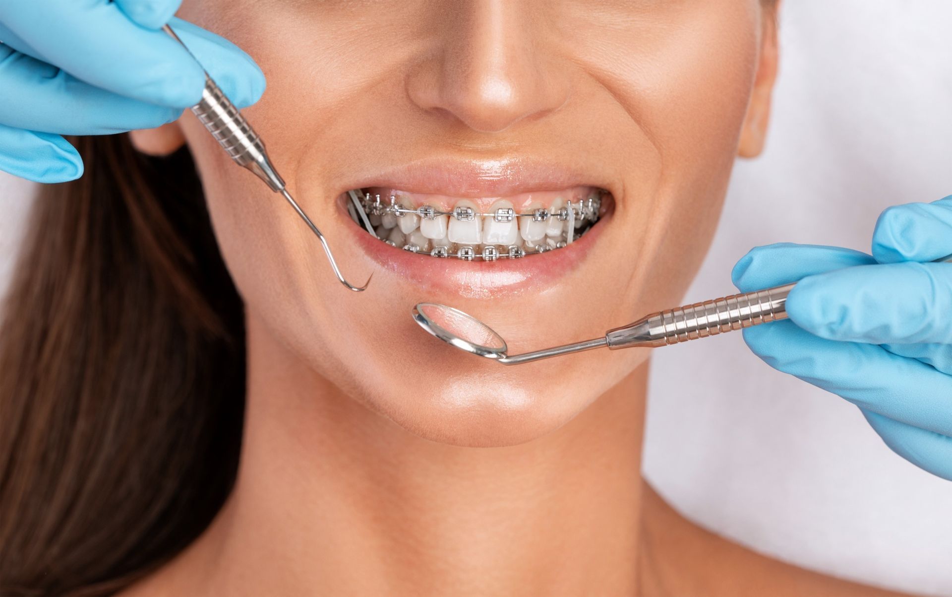 Una mujer con aparatos ortopédicos se hace examinar los dientes por un dentista.