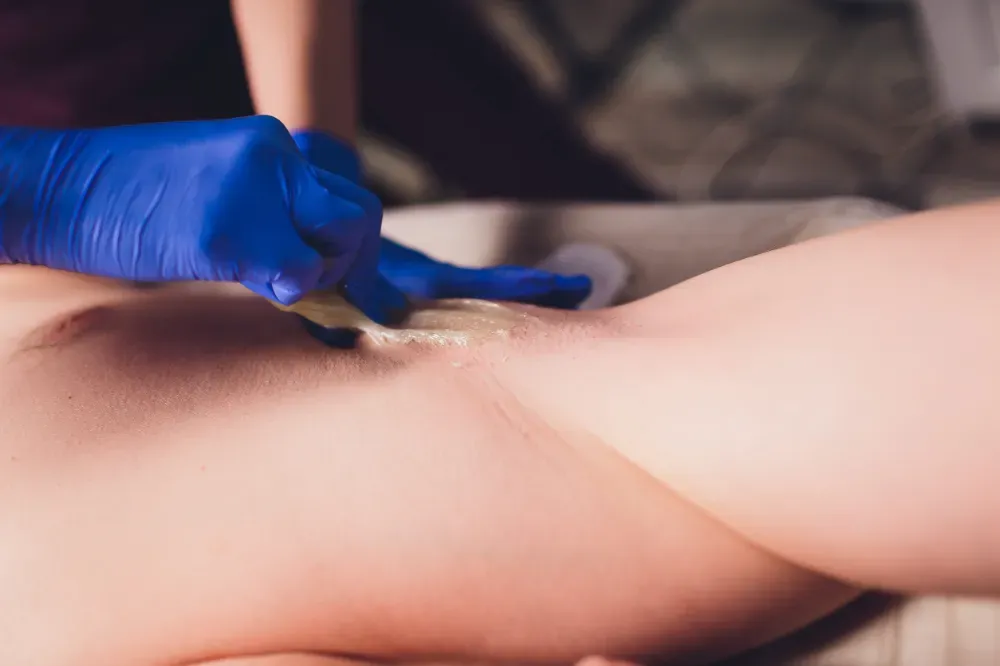 Una persona con guantes médicos azules aplica cera depilatoria en una axila.