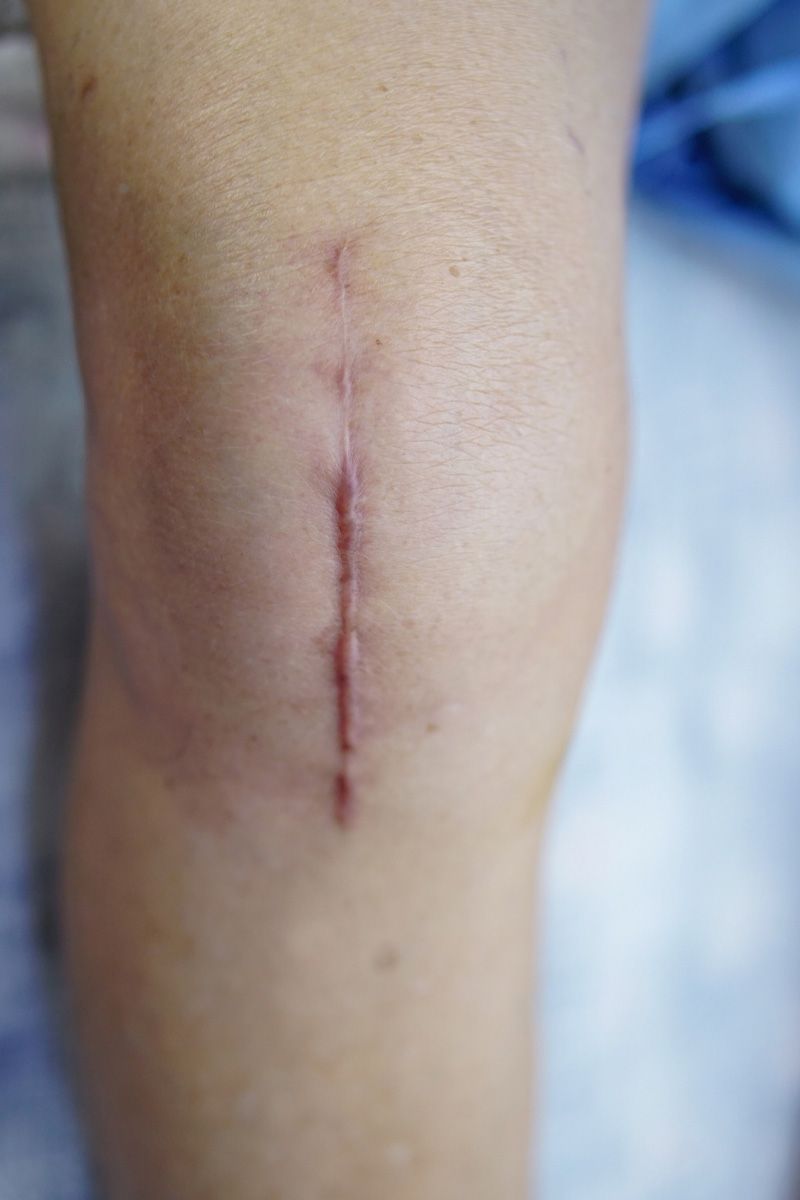 Mujer en ropa deportiva atándose los zapatos en la pista, con aspecto pensativo.