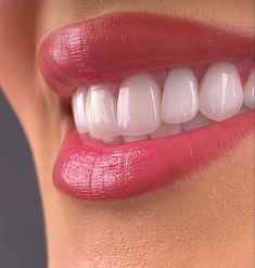 Un primer plano de la boca de una mujer con dientes blancos y labios rojos.