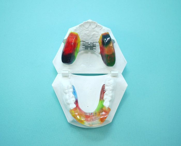 Un modelo de los dientes de una persona con aparatos ortopédicos sobre un fondo azul.