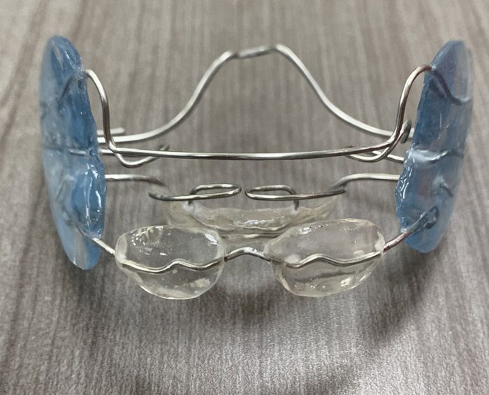 Un retenedor dental está sobre una mesa de madera.