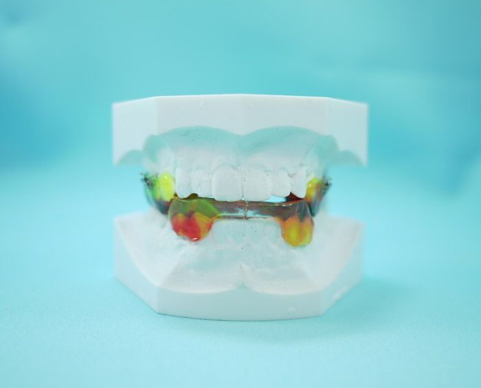 Un modelo de los dientes de una persona con aparatos ortopédicos sobre un fondo azul.