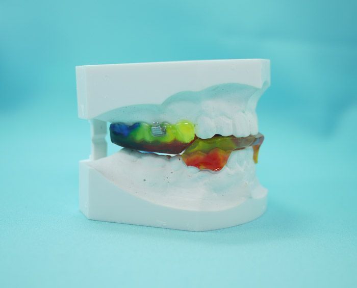 Un modelo de los dientes de una persona con aparatos ortopédicos sobre una superficie azul.
