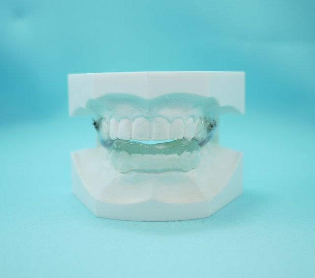 Un modelo de los dientes de una persona con aparatos ortopédicos sobre un fondo azul.