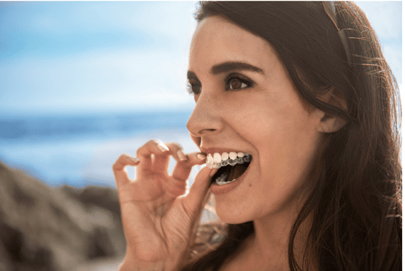 Una mujer lleva un aparato transparente en los dientes.