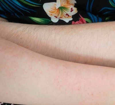 Un primer plano del brazo de una mujer con pelo.