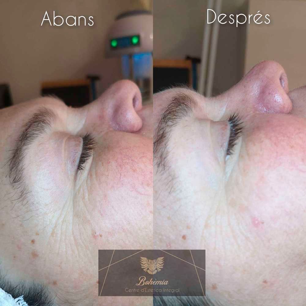 Una foto de antes y después del rostro de una mujer.