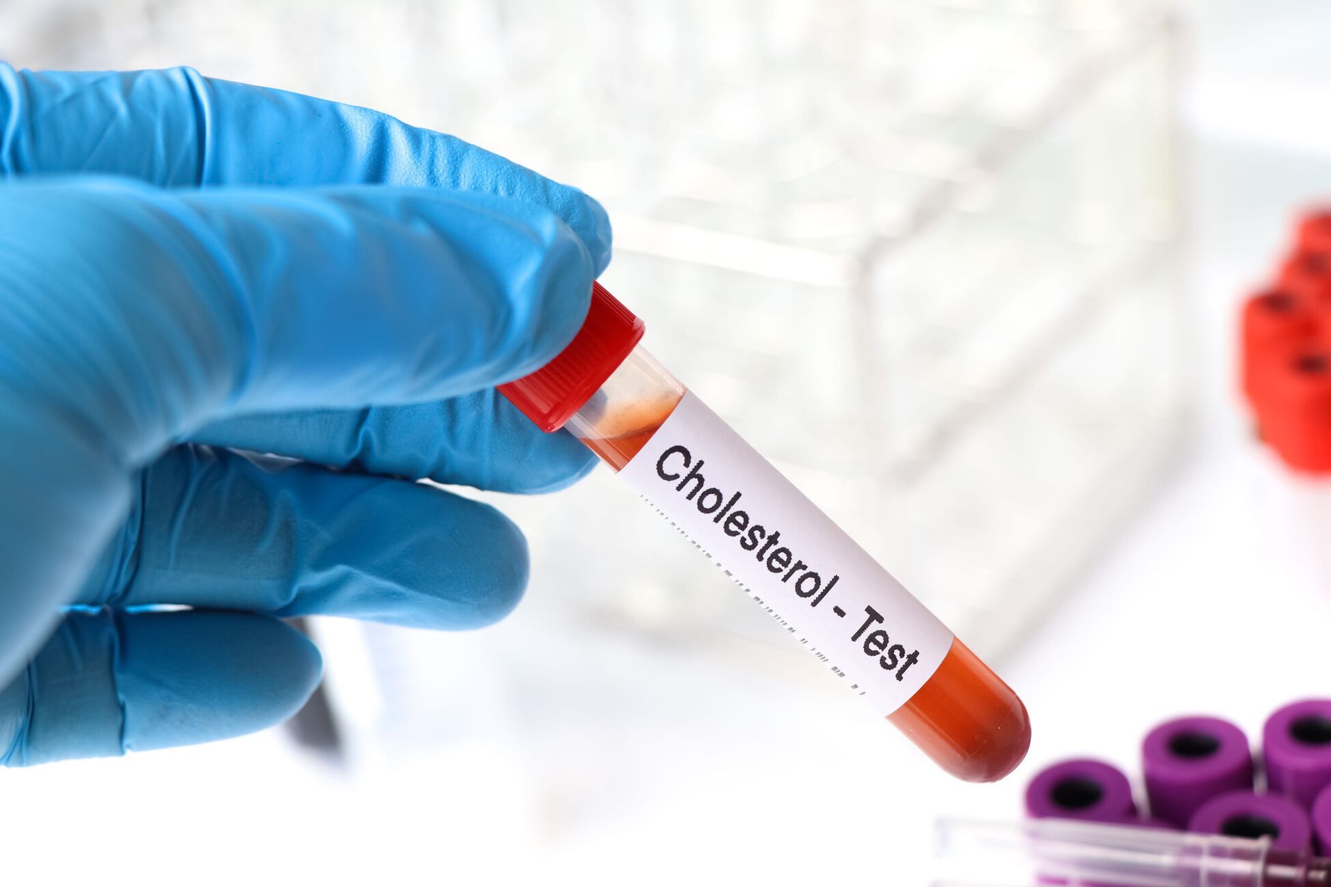 Mano enguantada sosteniendo un tubo de muestra de sangre etiquetado como 
