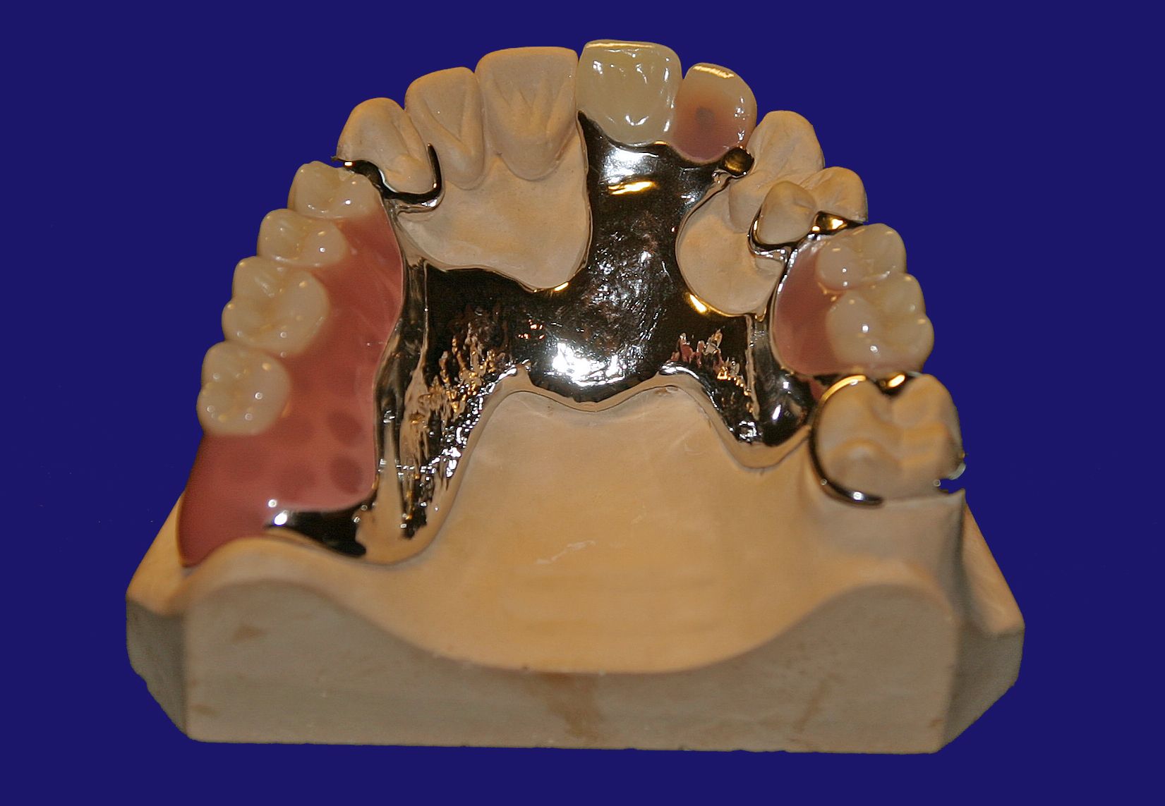 Dr. Klaus-Uwe Kauhold Einzelkronen 1