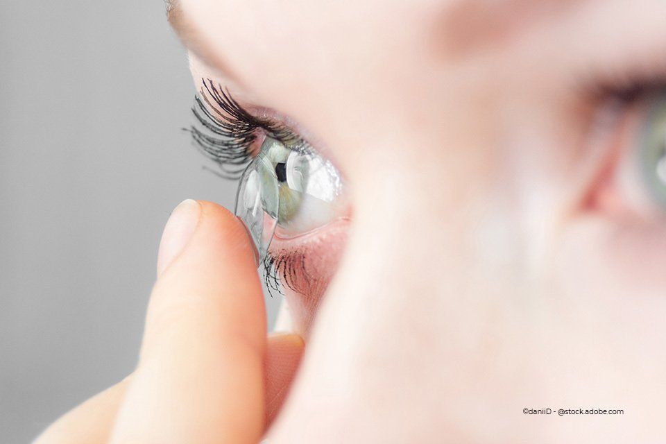 Kundin von Kaden Carmen-Sylvia Augenoptik Kaden setzt Kontaktlinse ein