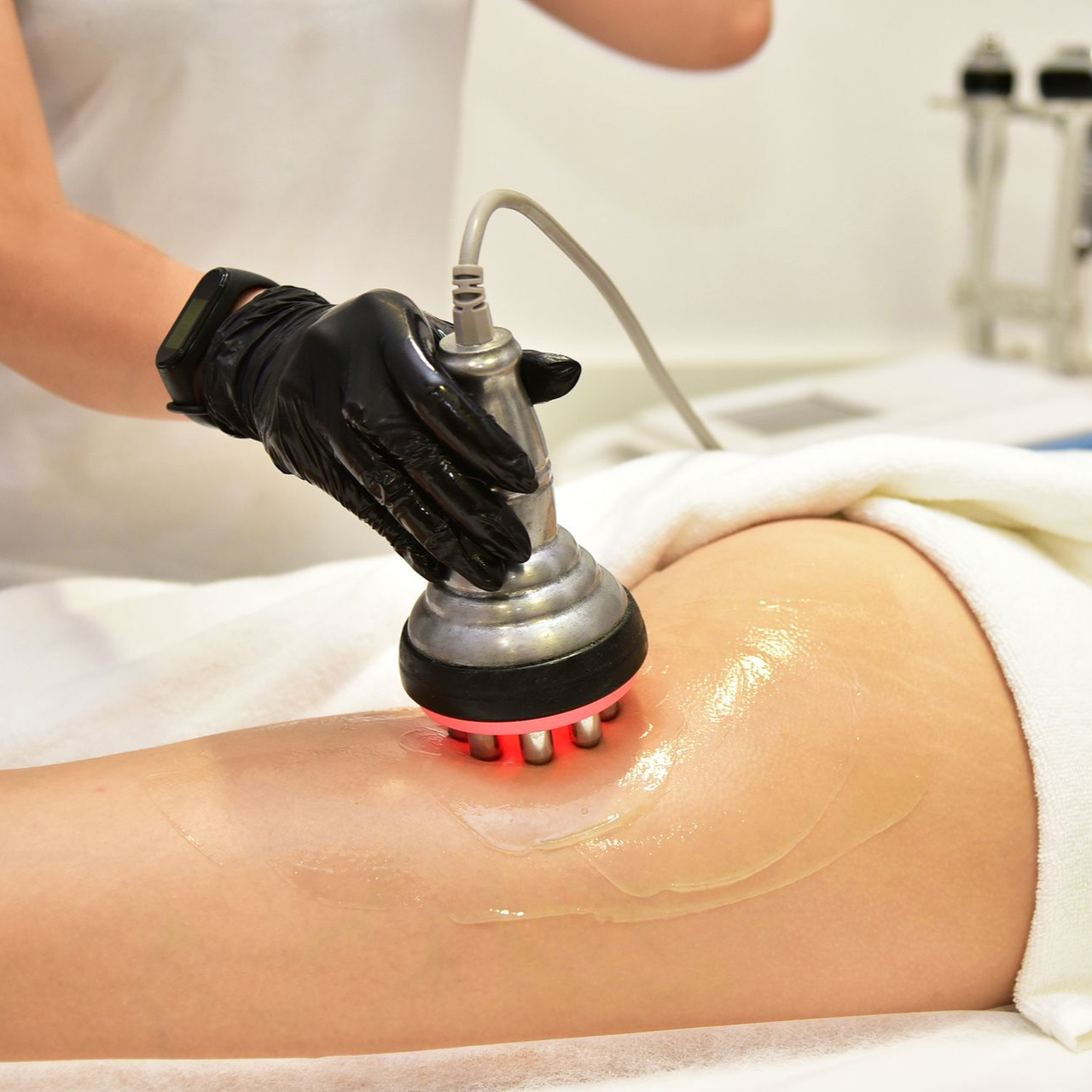 Ραδιοσυχνότητες RF Ραδιοσυχνότητες RF