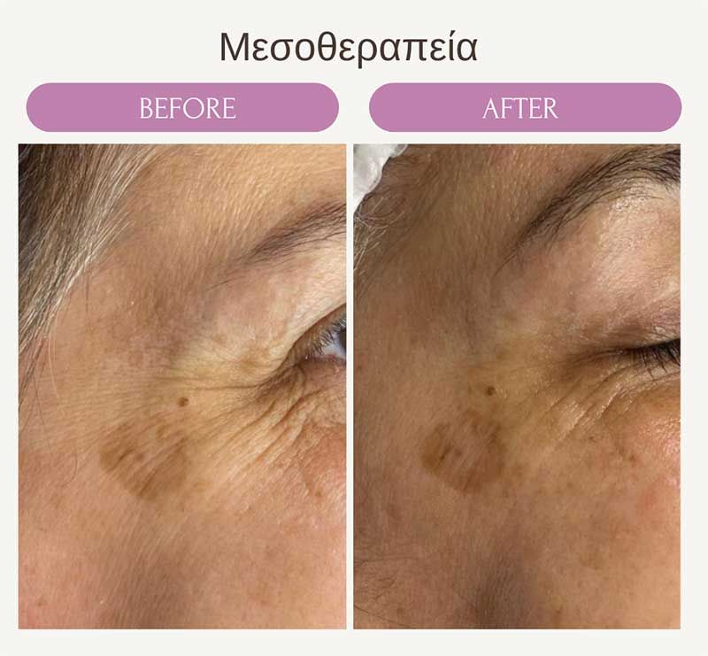 Ραδιοσυχνότητες RF