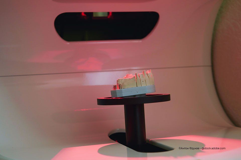 Lasertechnik im Zahnlabor Zahnkult GmbH
