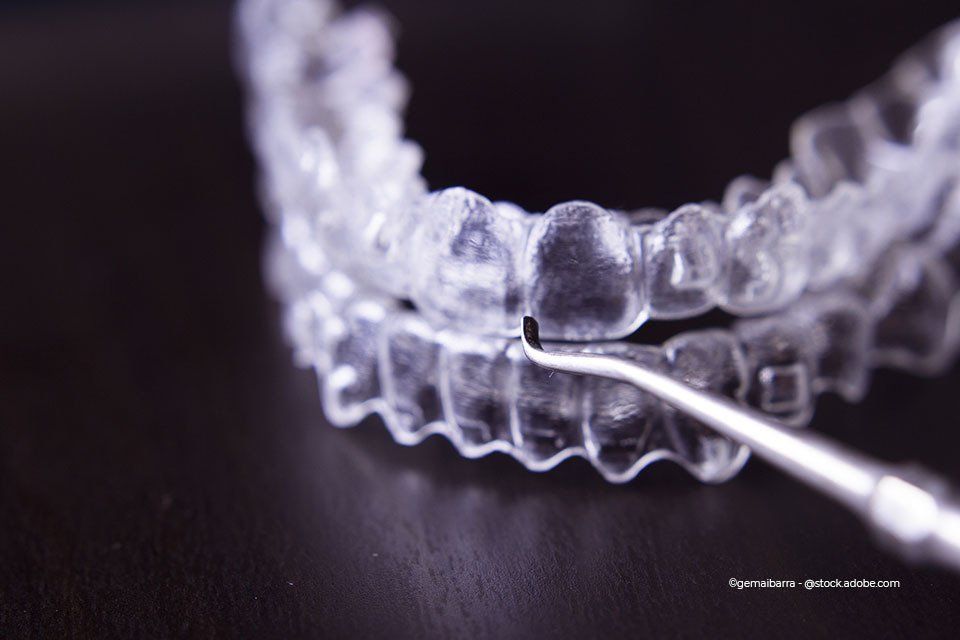 Zahnkult GmbH: Transparentes Kunststoffmodell einer Zahnspange