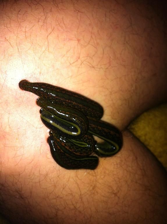 hirudothérapie - Mathieu Kägi - Vésenaz