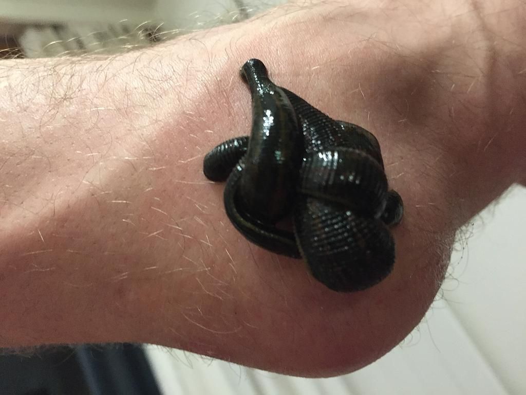 hirudothérapie - Mathieu Kägi - Vésenaz