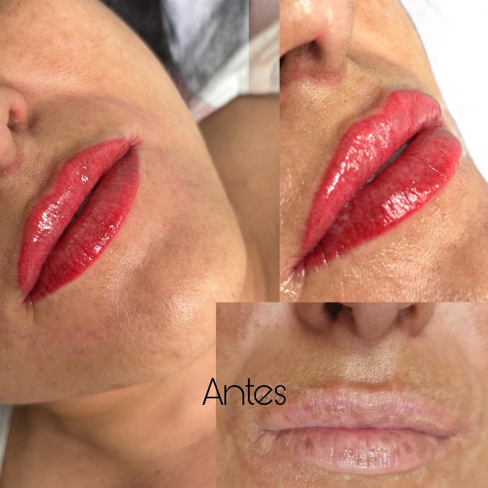 Labios antes y después de un tratamiento cosmético, mostrando el color rojo de los labios.