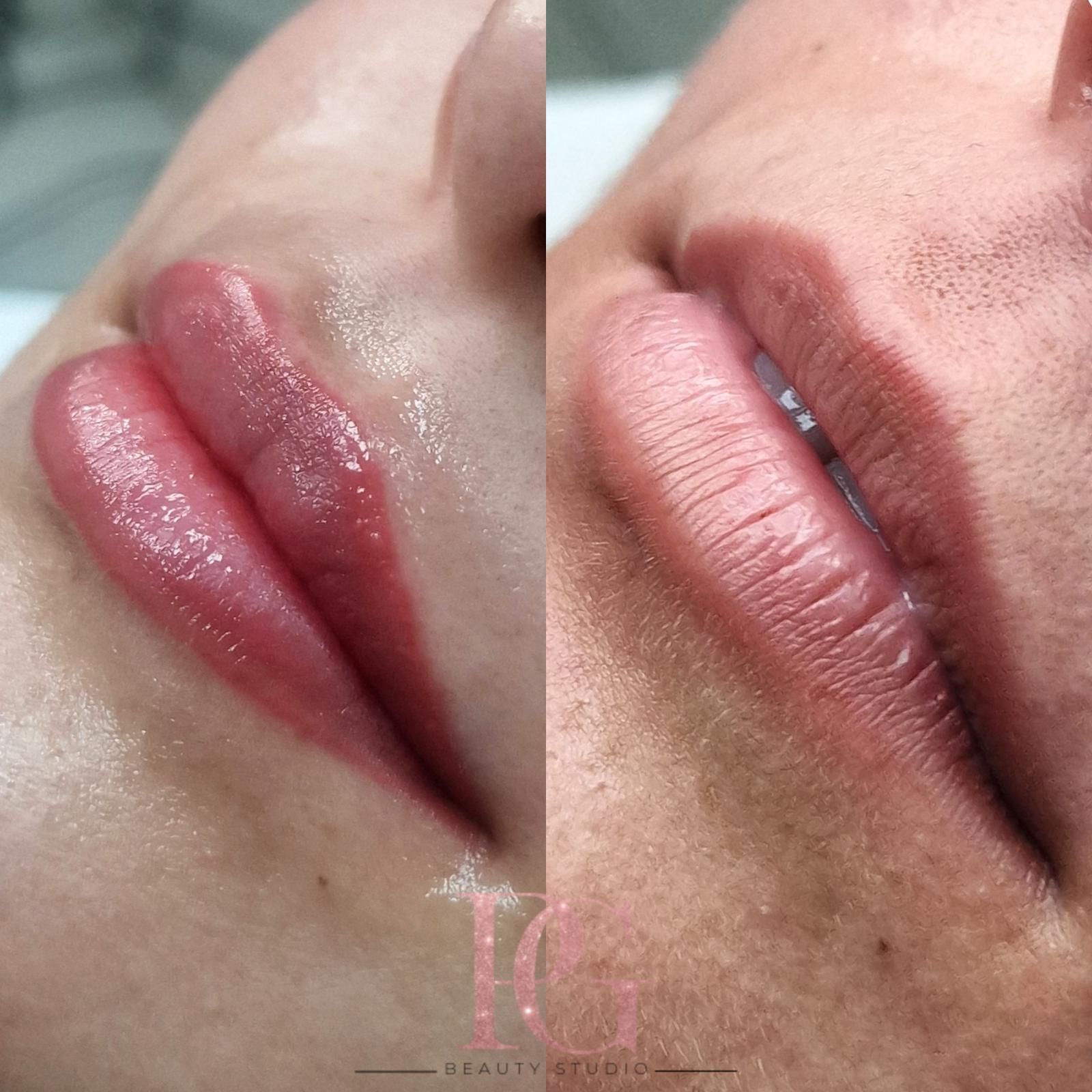 Dos imágenes de labios una al lado de la otra: una con pigmento rosa brillante y la otra con un aspecto más natural