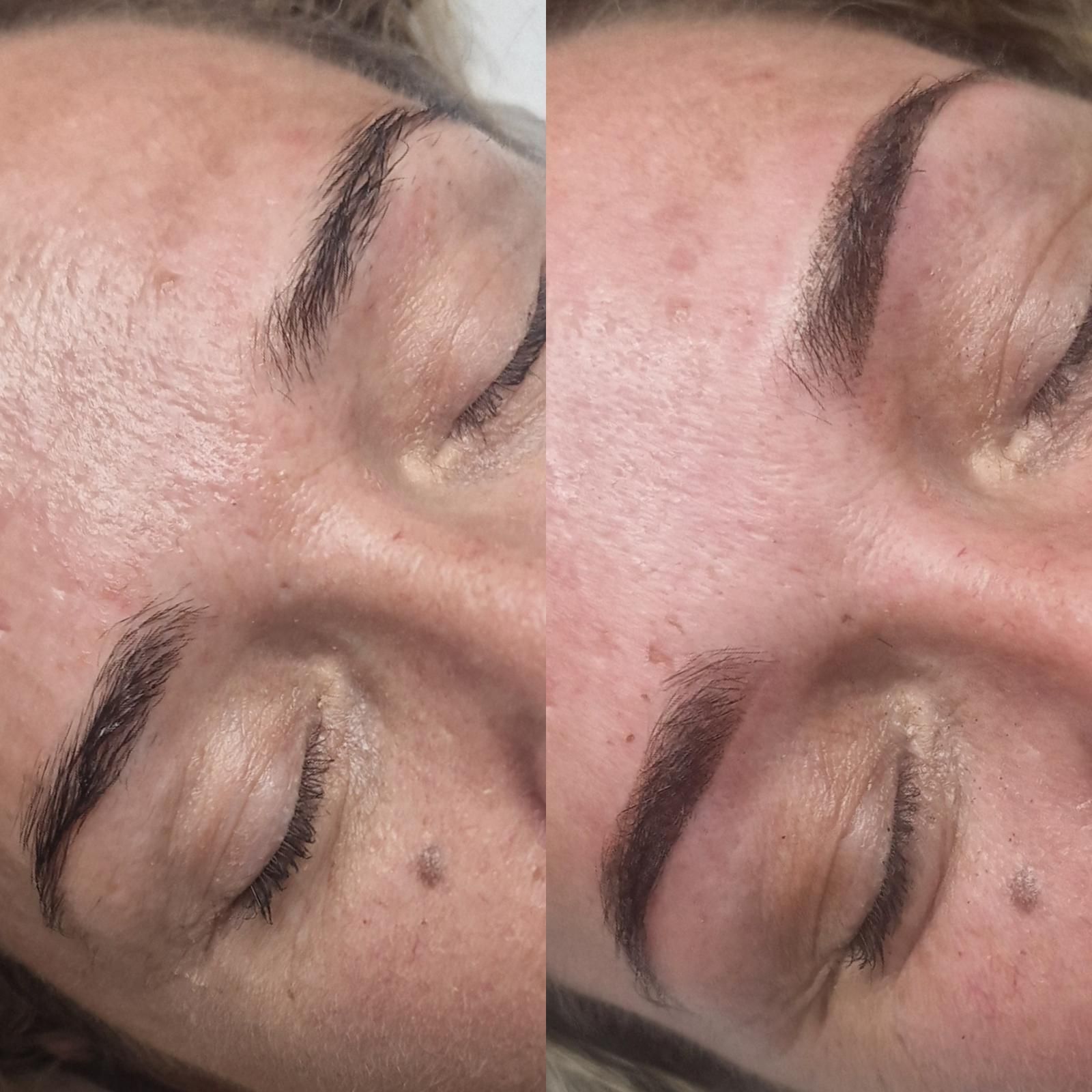 Dos fotografías en primer plano, una al lado de la otra, muestran los ojos de una persona y sus cejas marrones oscuras recién