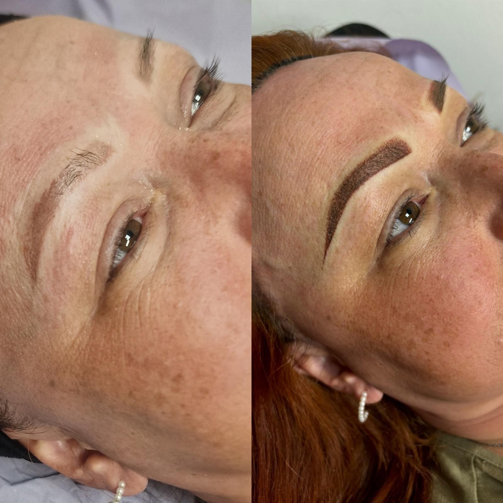 Antes y después de la microblading de cejas en el rostro de una persona; un lado muestra cejas escasas