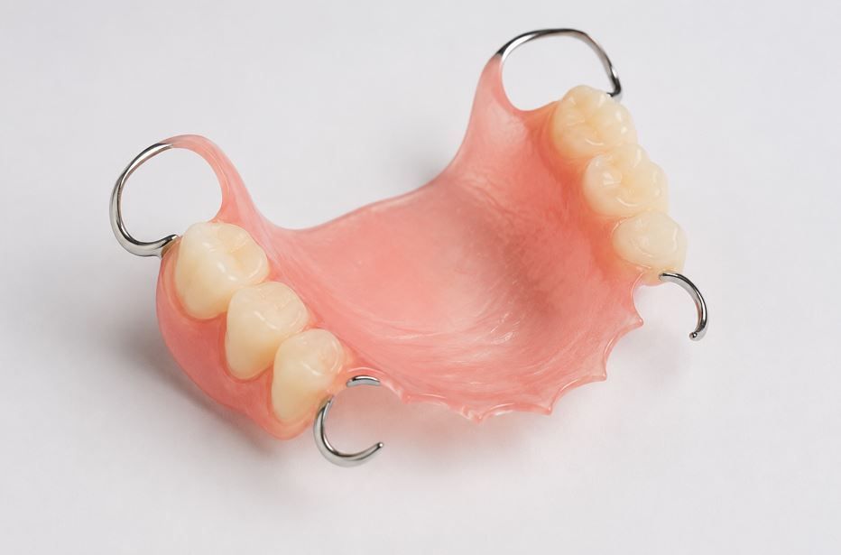 Prótesis parcial removible rosa con dientes artificiales y ganchos metálicos sobre fondo blanco.