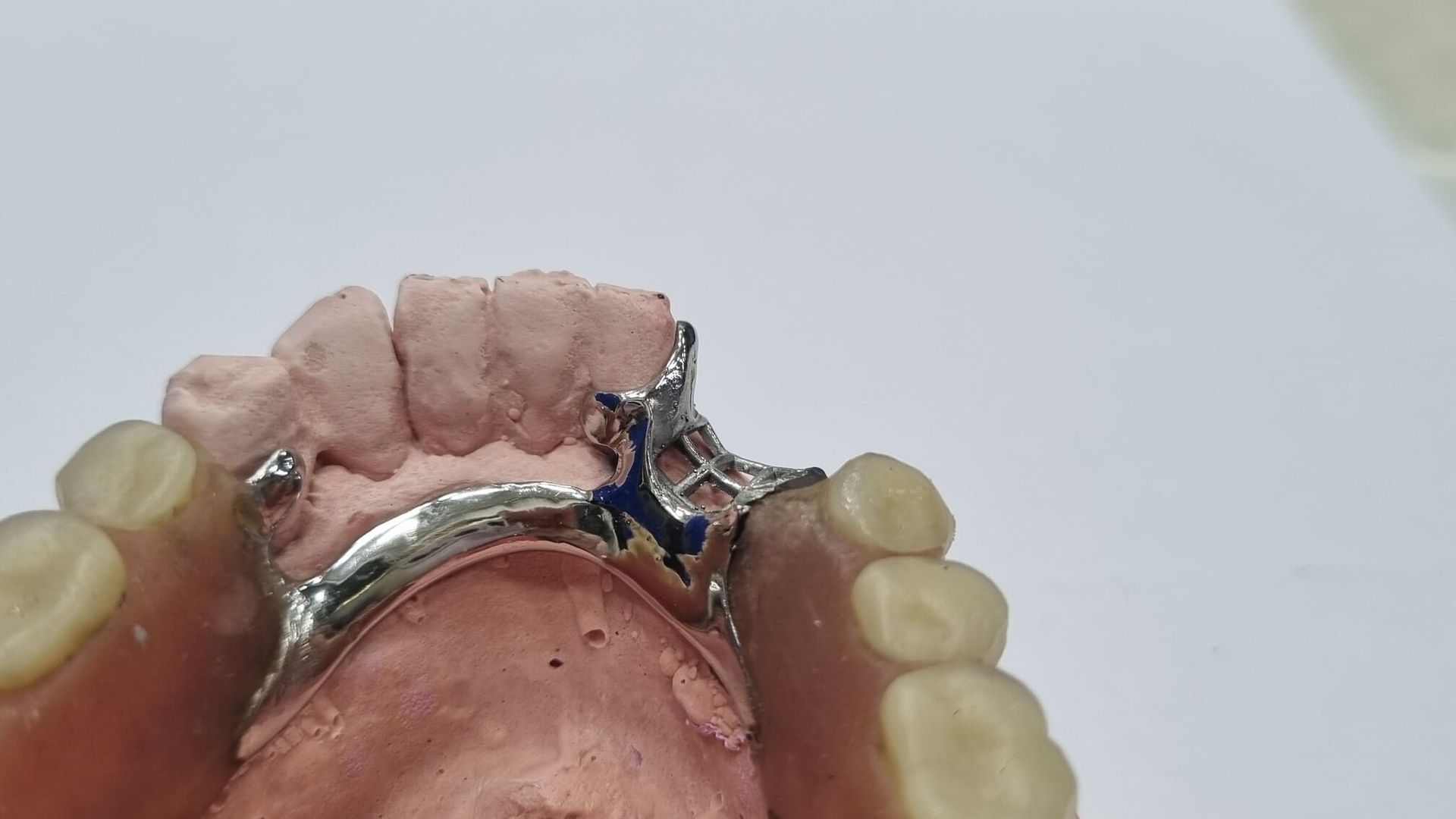 Un primer plano de una dentadura postiza con un anillo en ella.