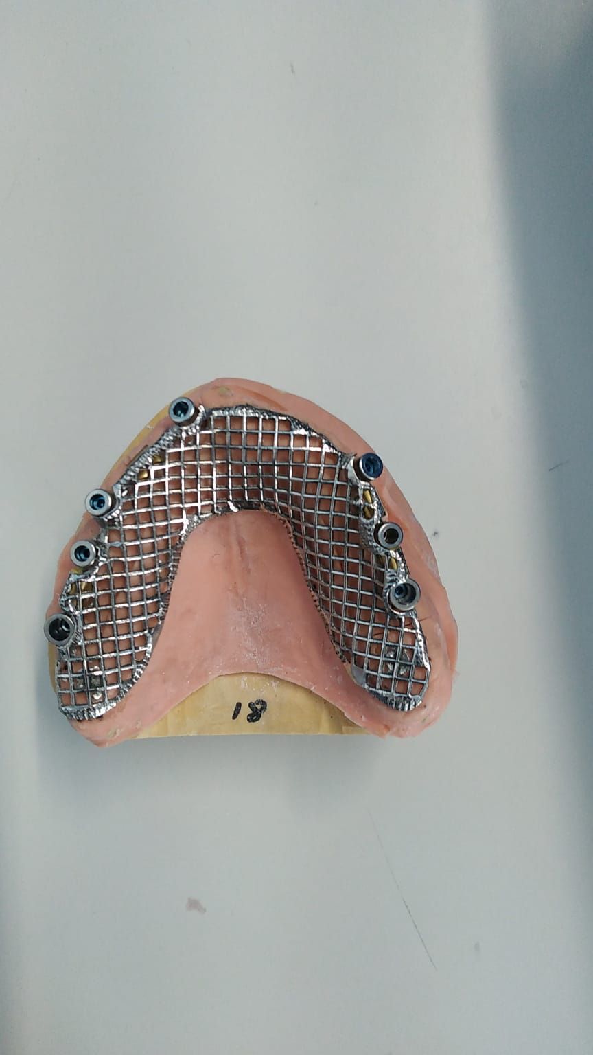 Un primer plano de un aparato dental sobre una superficie blanca.