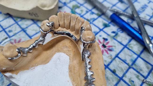 Un primer plano de un modelo dental en una mesa con instrumentos dentales.