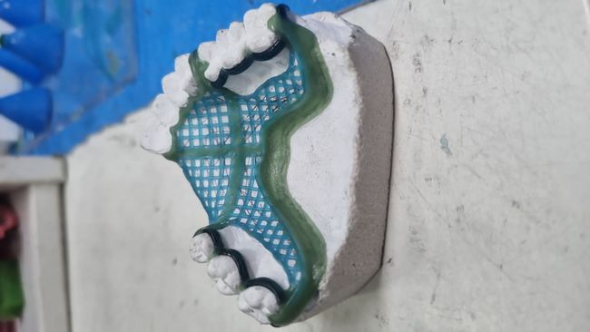 Un modelo de los dientes de una persona está colgado en una pared.