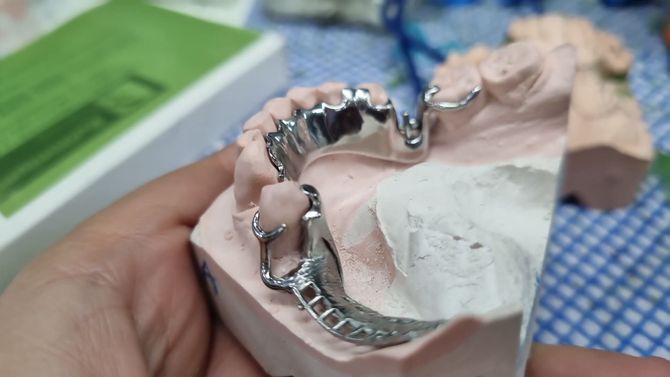 Una persona sostiene un modelo dental en su mano.