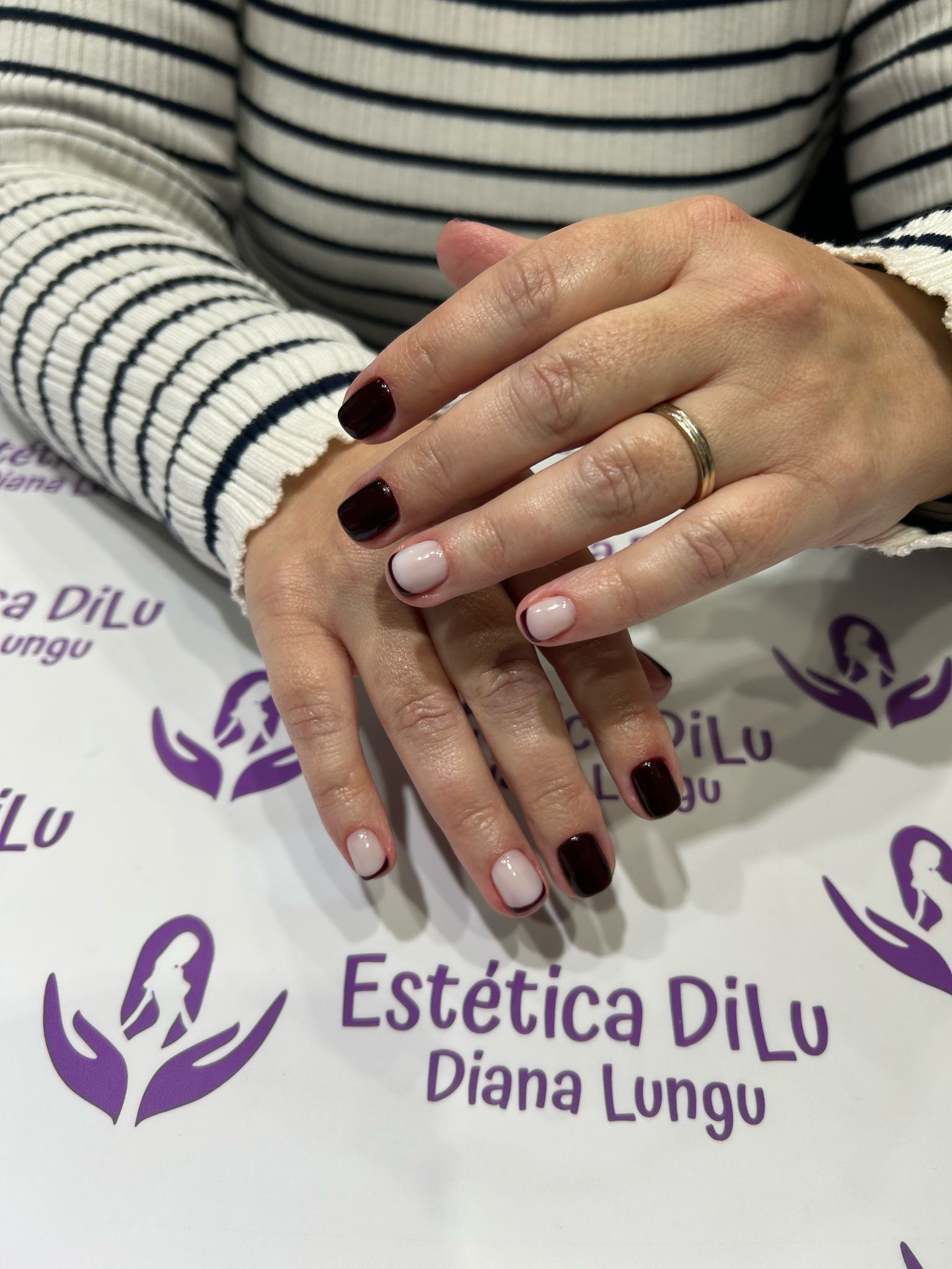 Un primer plano de la mano de una mujer con un anillo.