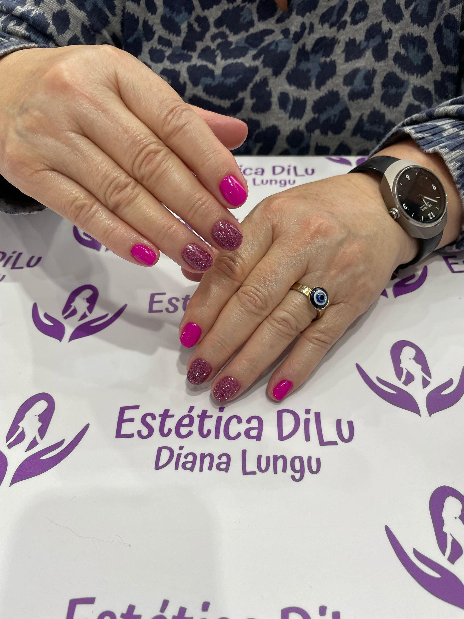 Las uñas de una mujer están pintadas de rosa y lleva un reloj.