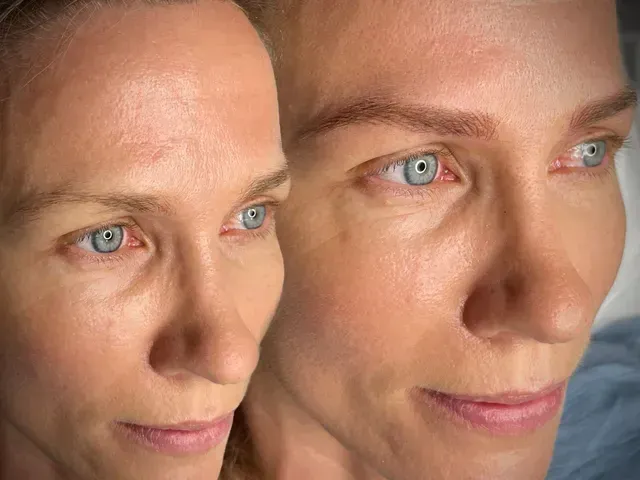 Antes y después de las cejas de una persona. La derecha muestra cejas más pobladas y oscuras; la izquierda, cejas dispersas.