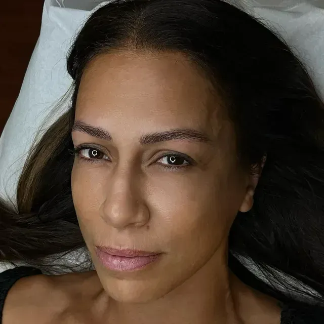 Mujer con cabello castaño y cejas color marrón claro, tumbada sobre una superficie blanca, mirando a la cámara.