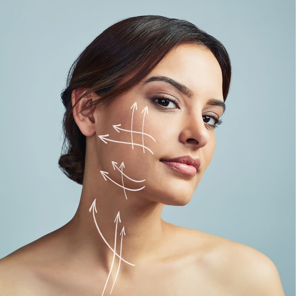 Facelifting mit weißen Richtungspfeilen auf Wange und Hals, die potenzielle Bereiche für kosmetische Behandlungen anzeigen.