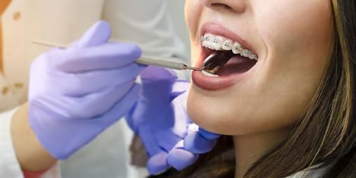 Eine Frau mit Zahnspange lässt ihre Zähne von einem Zahnarzt untersuchen.