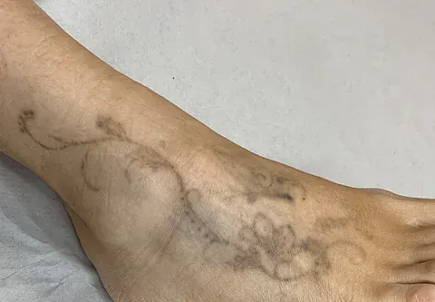 Un primer plano del pie de una persona con un tatuaje.