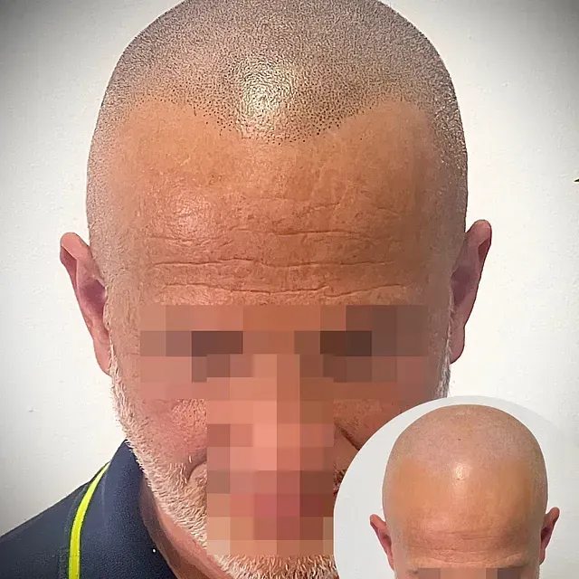 Un hombre con la cabeza rapada y barba está de pie frente a un fondo blanco.