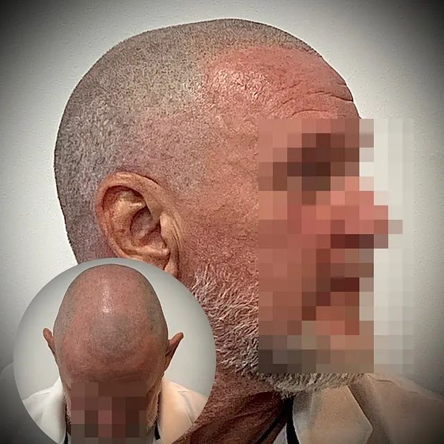 Un hombre con la cabeza rapada y barba.