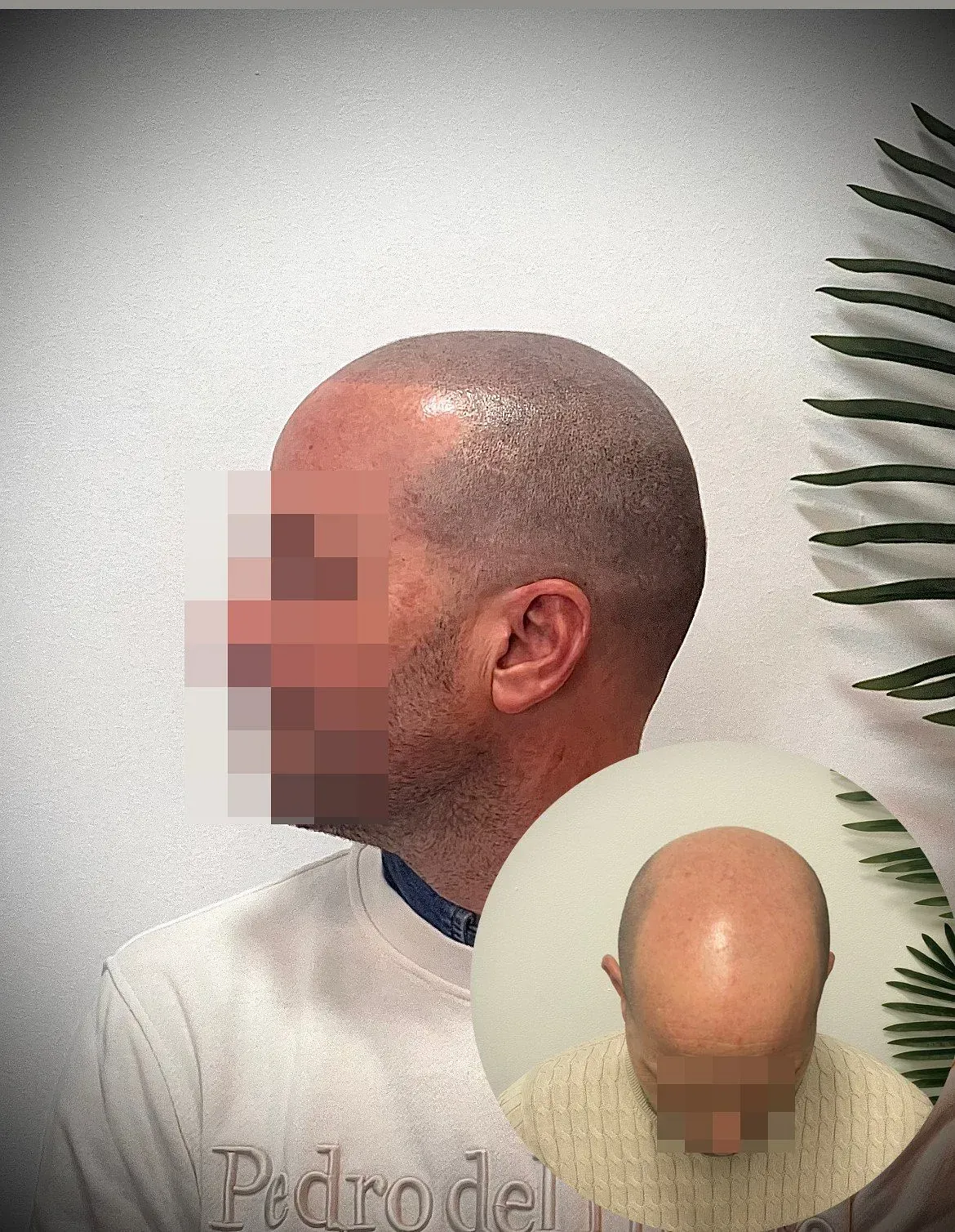 Un hombre con la cabeza rapada está parado frente a una planta.